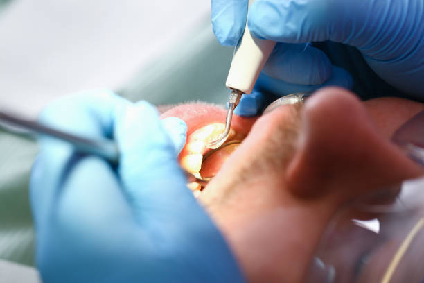 Best Emergency Treatment for Dental Infections or Abscesses in New River, AZ